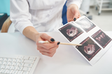 2. Trimester der Schwangerschaft – Was erwartet mich während der Schwangerschaft?